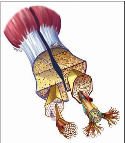 Tendinopathy - By Dr. Michael Prebeg